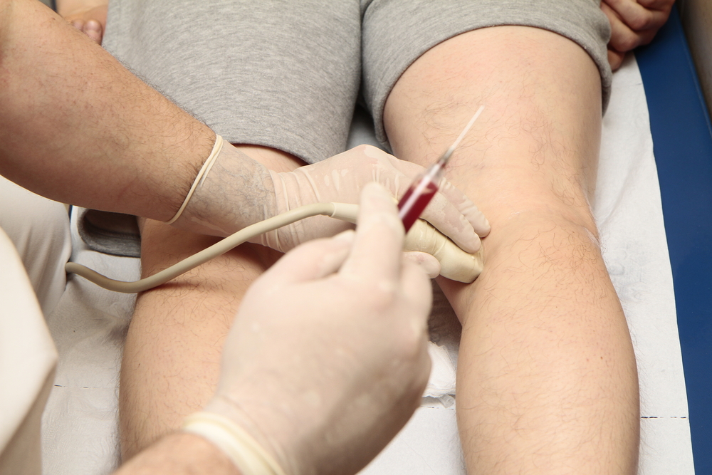 Man having stem cell Injections in New York